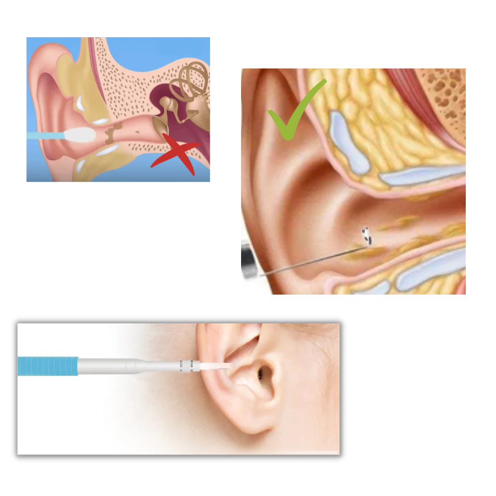 Caméra auriculaire 3 en 1 – Image 8