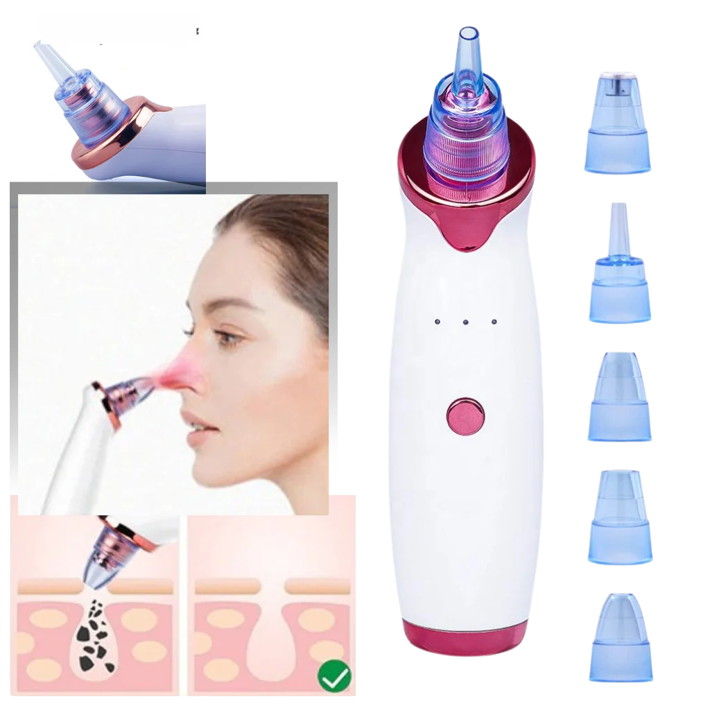 Petit aspirateur extracteur de points noirs – Image 2