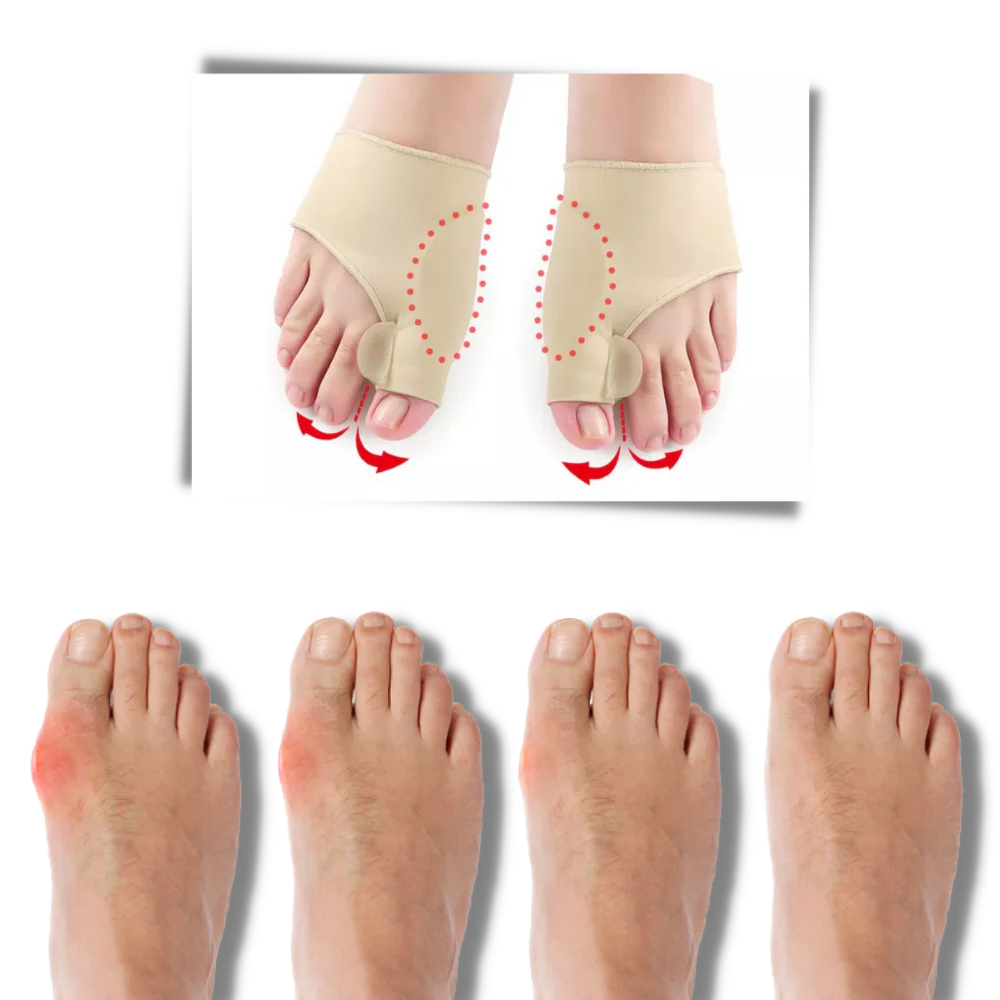 Correcteur d'oignons de pieds en gel – Image 5