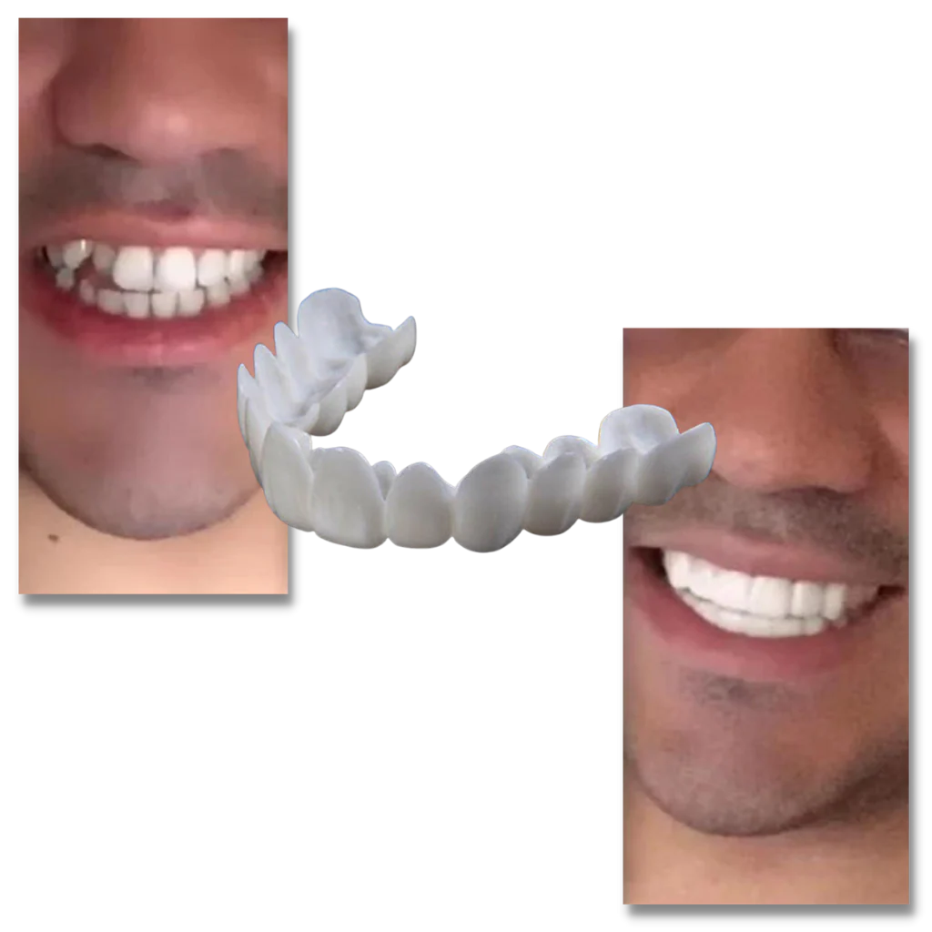Couverture dentaire sourire parfait - gouttière confortable – Image 4