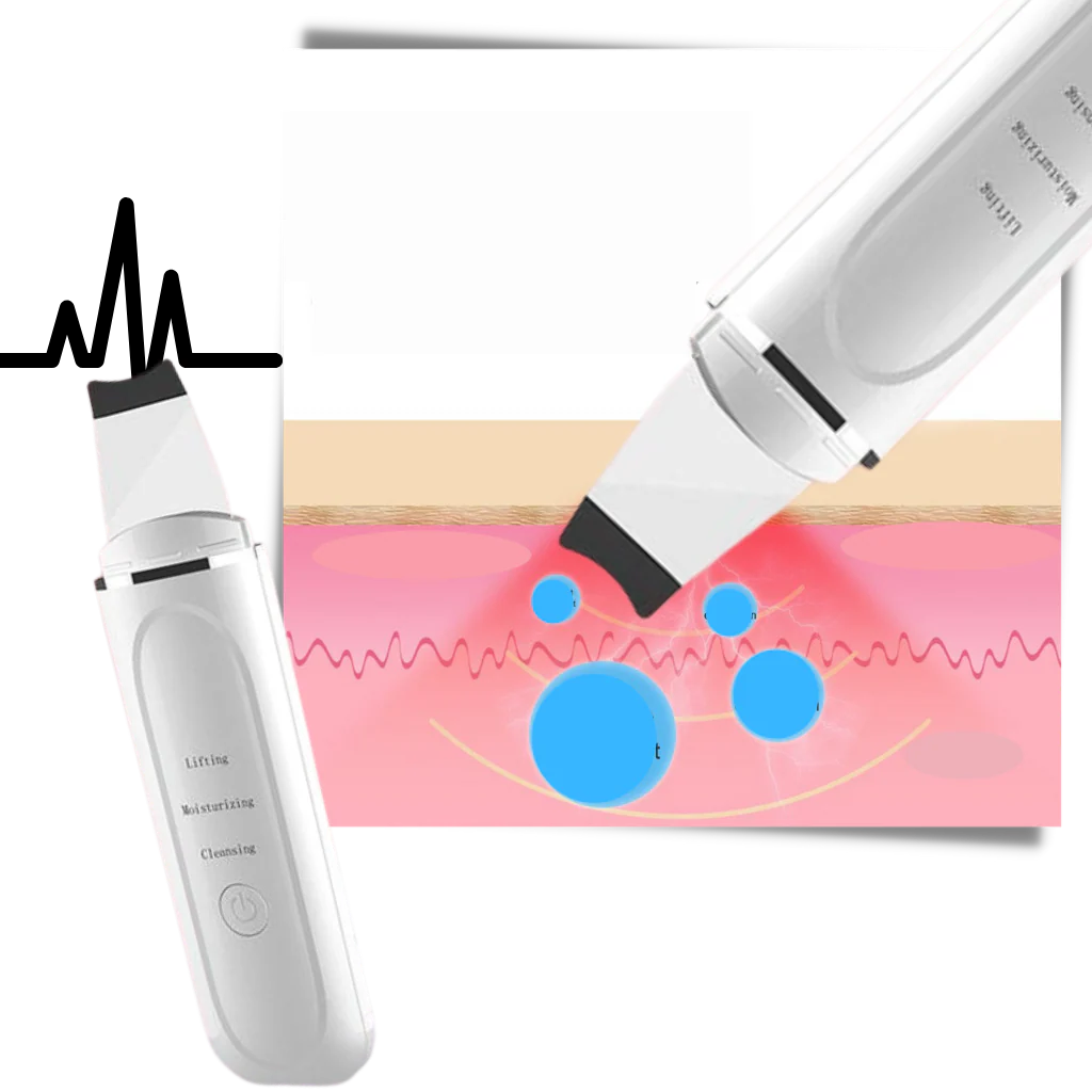 Spatule exfoliante ultrasonique pour le visage – Image 7