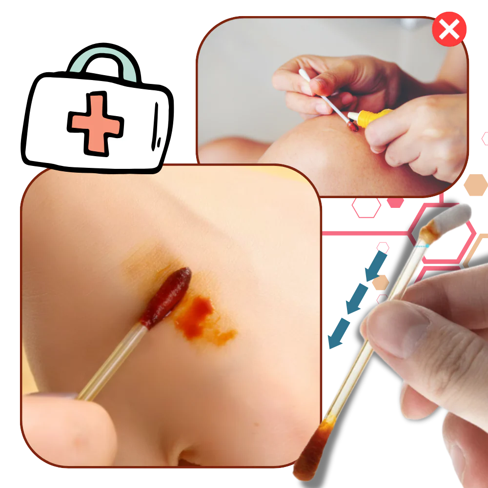 Cotons-tiges à l'iode et à l'alcool – Image 4