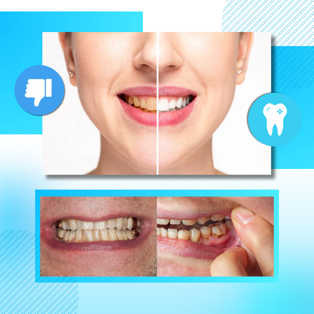 Bandes de blanchiment des dents au charbon et à la menthe – Image 7
