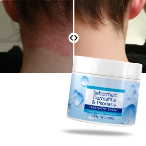 Crème hydratante pour le cuir chevelu