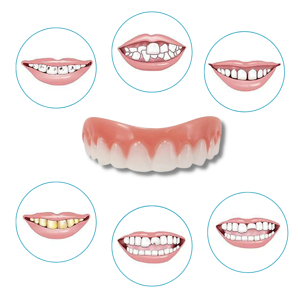 Facettes dentaires à clipser – Image 9