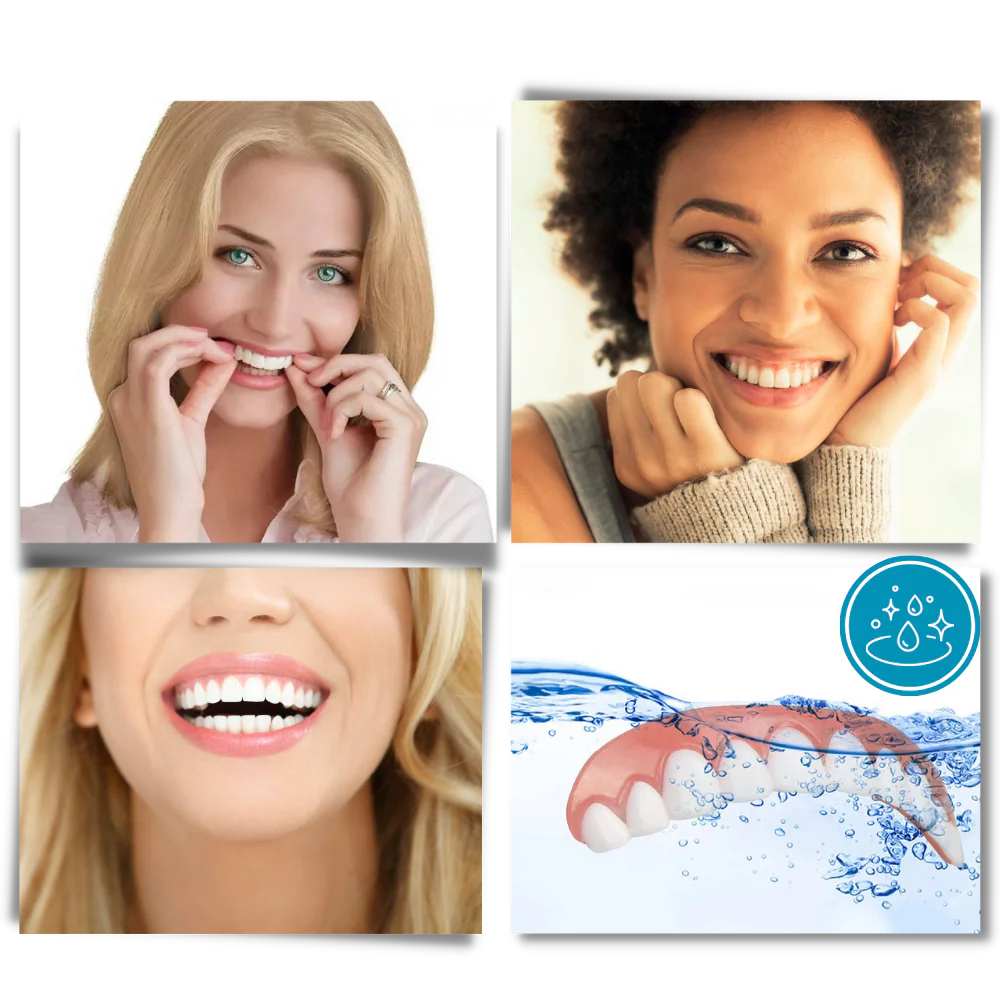 Facettes dentaires à clipser – Image 5